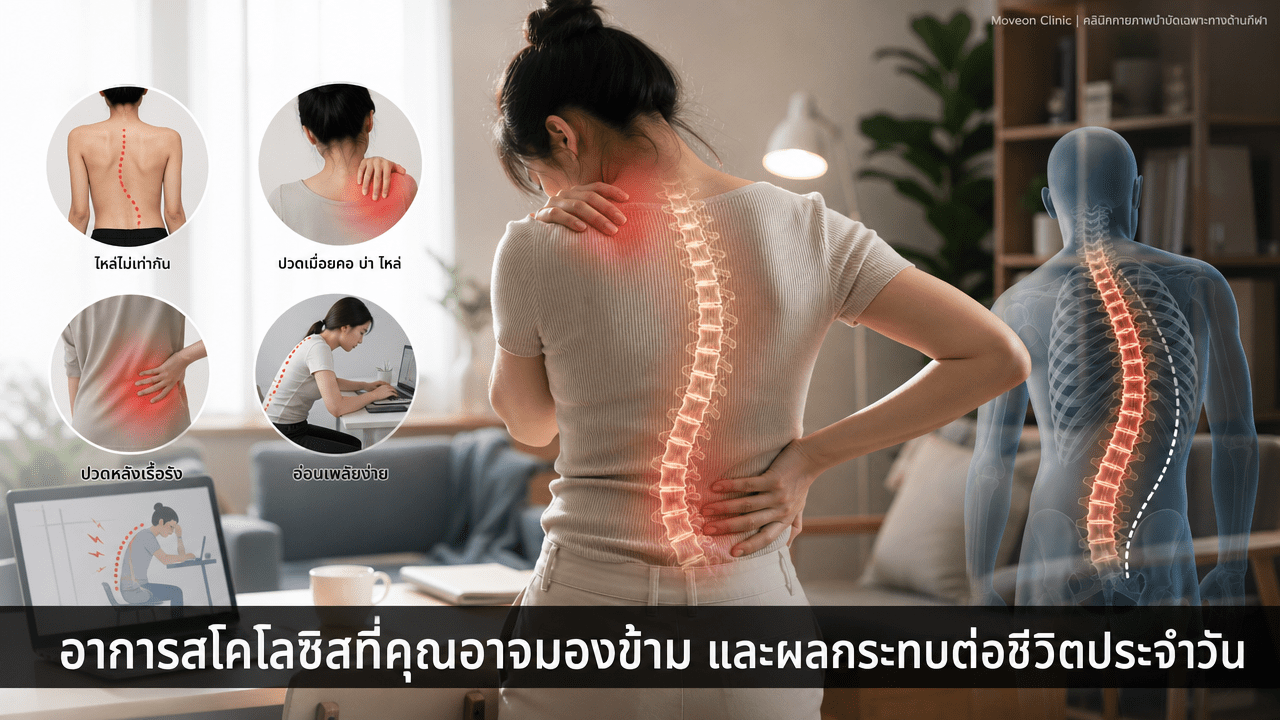 อาการสันหลังคดที่คุณอาจมองข้ามและผลกระทบต่อชีวิตประจำวัน