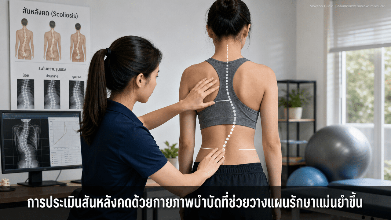 การประเมินสันหลังคดด้วยกายภาพบำบัดที่ช่วยวางแผนรักษาแม่นยำขึ้น