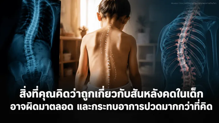 สิ่งที่คุณคิดว่าถูกเกี่ยวกับสันหลังคดในเด็ก อาจผิดมาตลอด และกระทบอาการปวดมากกว่าที่คิด